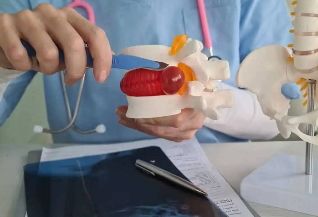 ساخت هیدروژل تزریقی خودترمیم‌شونده برای درمان دیسک بین‌مهره‌ای