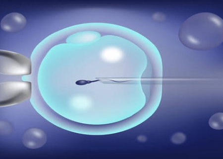 موفقیت ۵۱ درصدی درمان در بخش IVF بیمارستان الزهرا(س) رشت